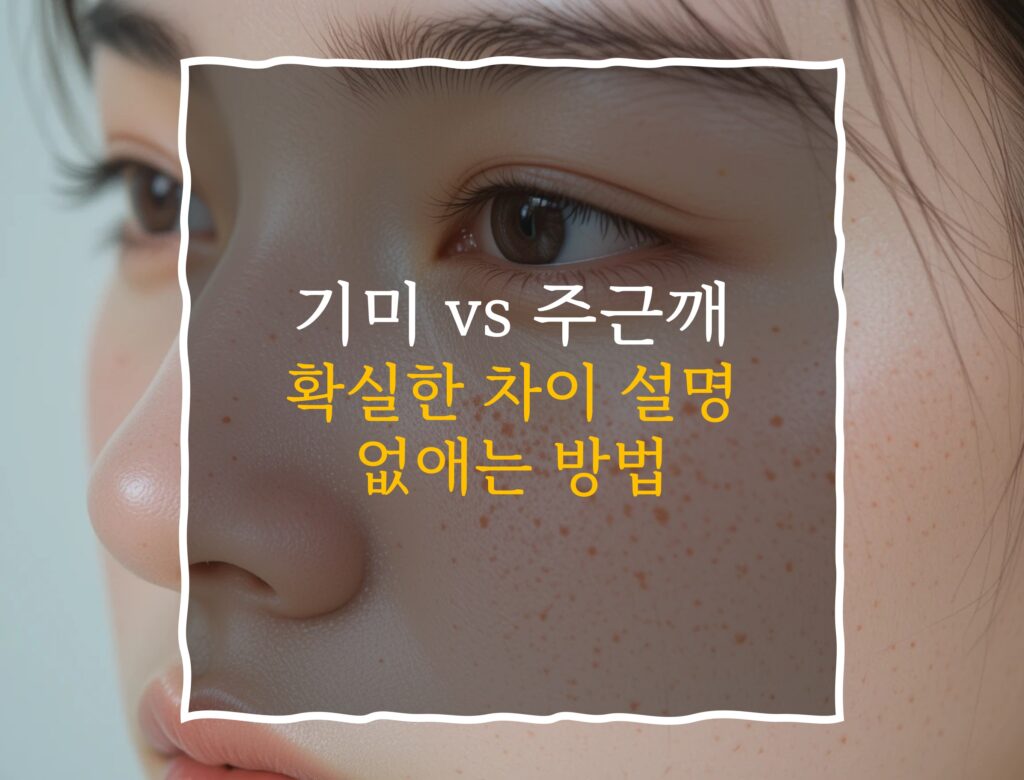 기미와 주근깨 차이