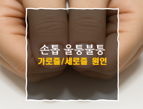 손톱 울퉁불퉁 원인